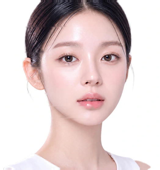 ใบหน้าที่ทำเครื่องหมายบริเวณฉีดฟิลเลอร์