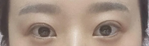 수술후기
