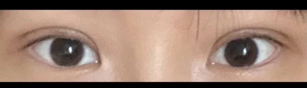 수술후기