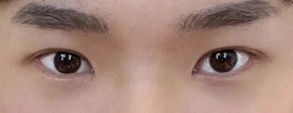 수술후기