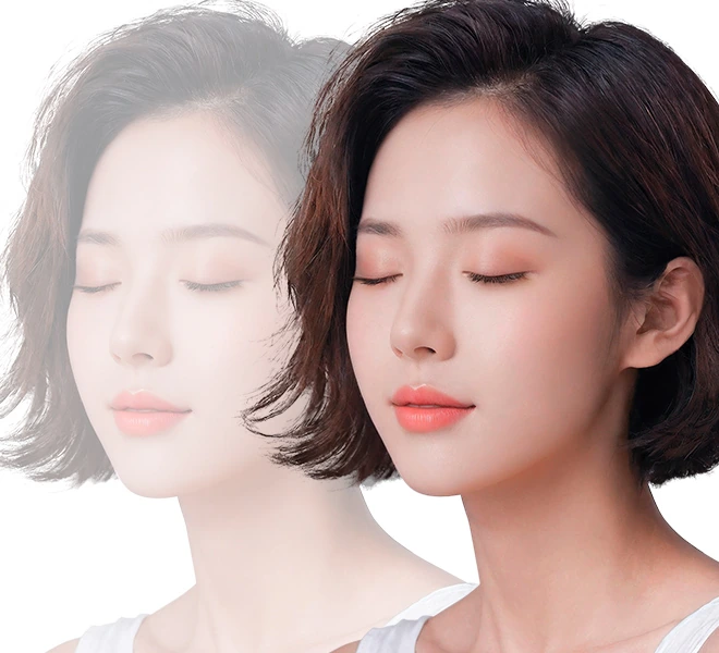 이마축소와 이마거상을 함께 표현한 이미지