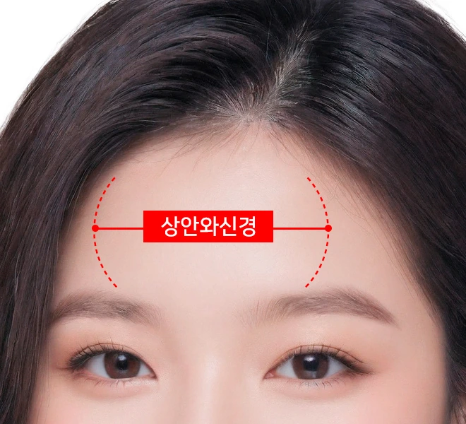 상안와신경 보존을 표현한 이미지