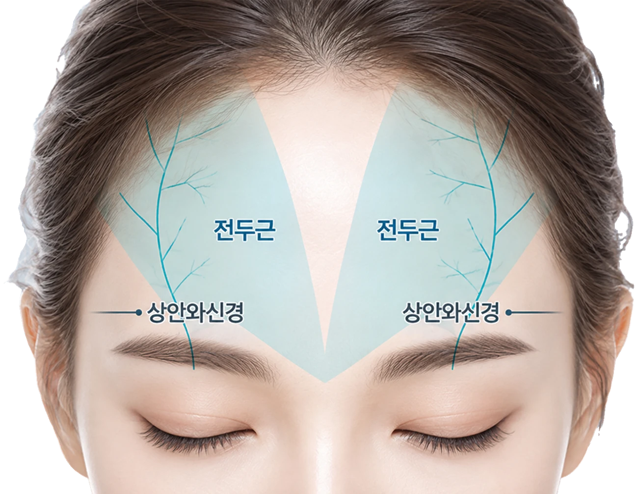 전두근과 상안와신경 위치 도해