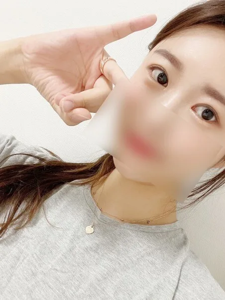 소세지눈 재수술 후기