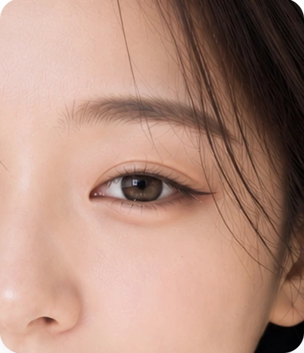 상안부 처짐 개선 — 눈매, 눈꼬리 처짐