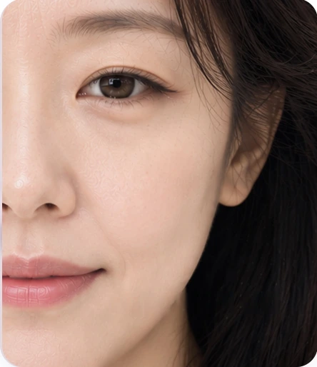 중안부 처짐 개선 — 앞볼 처짐, 팔자주름