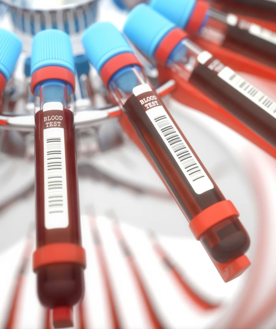 Memisahkan dan mengekstraksi faktor pertumbuhan sel punca secara presisi